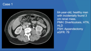 Case 1- Diagnosis and Treatment Options for an Incidentally Found Small Renal Mass-featured