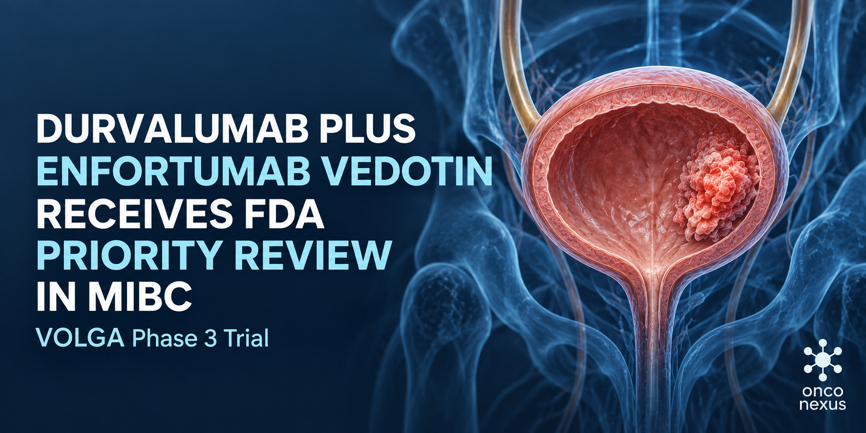 FDA Grants Priority Review to Perioperative Durvalumab Plus Neoadjuvant Enfortumab Vedotin in MIBC