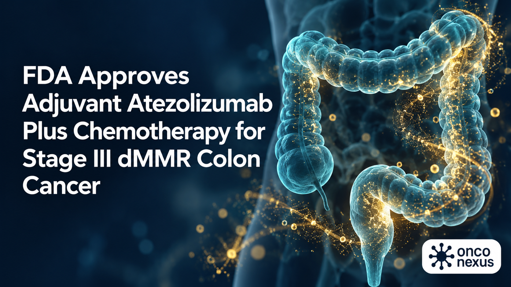 FDA Approves Adjuvant Atezolizumab Plus Chemotherapy for Stage III dMMR Colon Cancer